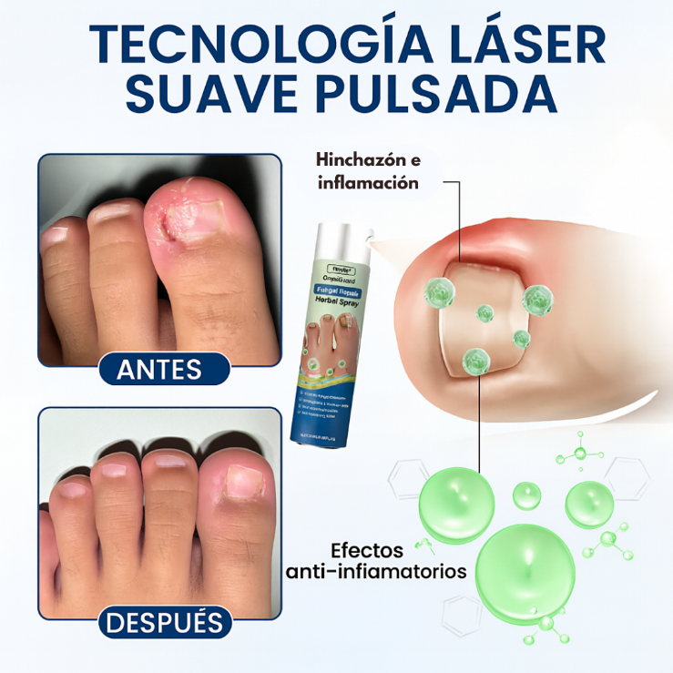 Oferta 2X1 Timilk - OnyxiGuard Spray Herbal de Reparación Fúngica| El secreto natural para uñas sanas y atractivas.
